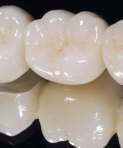 Răng Sứ Zirconia
