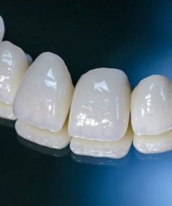 răng sứ lava 3m