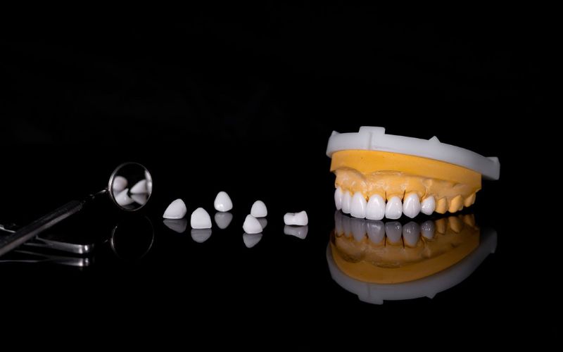 răng sứ orodent